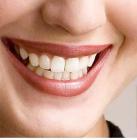 The most harmless and safe teeth whitening