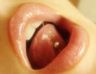 From piercing tongue crumbled teeth and grow a second tongue