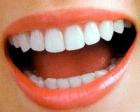 Treatment of diseases of teeth herbal
