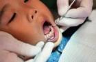 Treatment of milk teeth