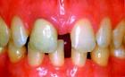 Anomalies of teeth
